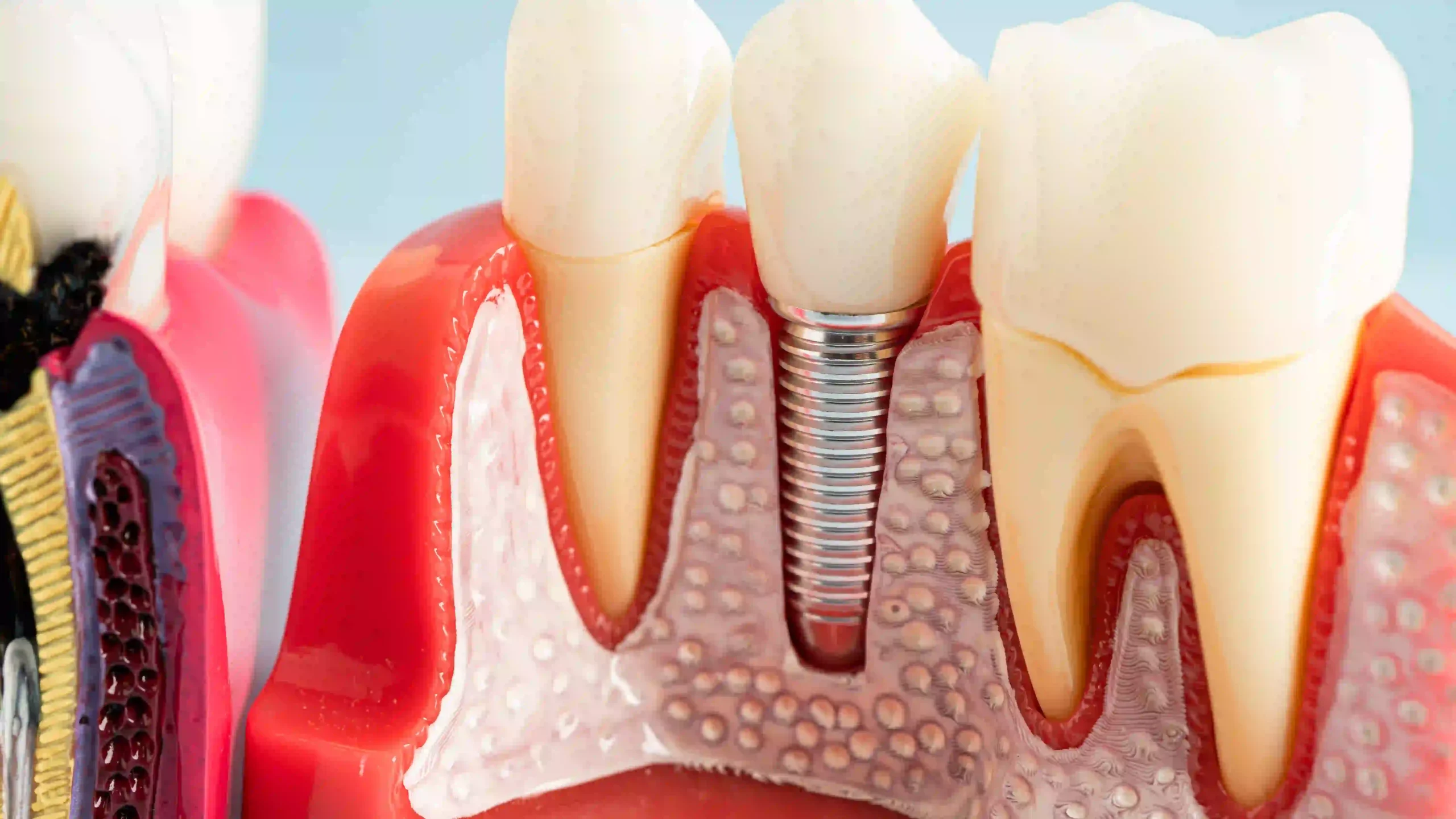 Dent Denizli Diş Kliniği Dental İmplant Bilgilendirme ve Muayene Alanı