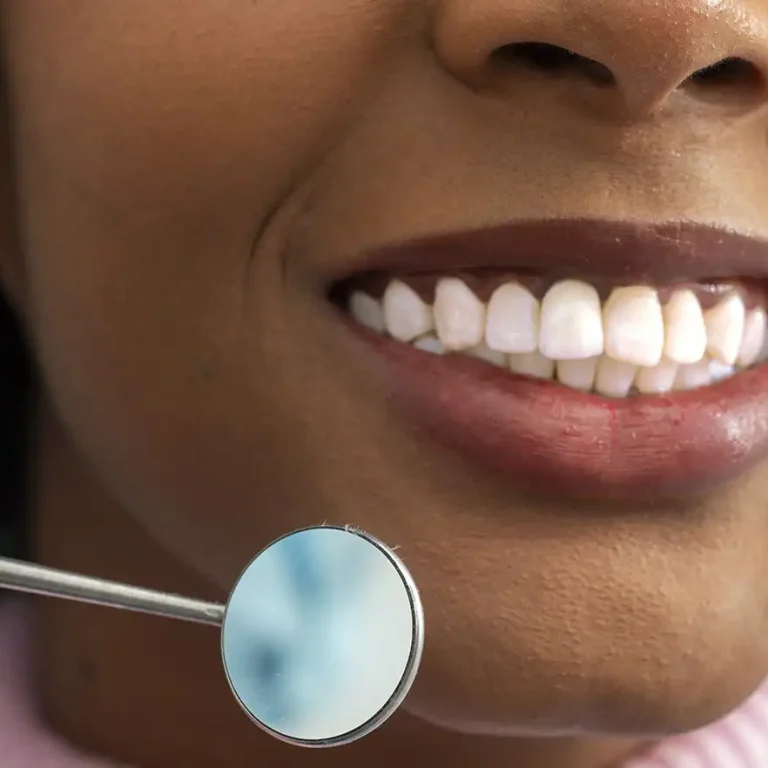 Denizli kliniğimizde uygulanan estetik restoratif diş tedavisi ve diş yapısı onarım süreçleri.